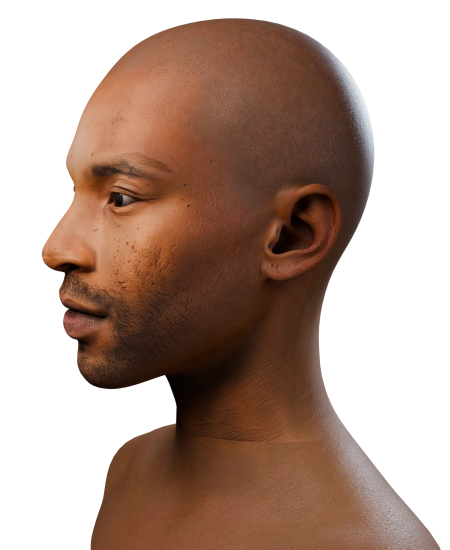 Head on the template neck