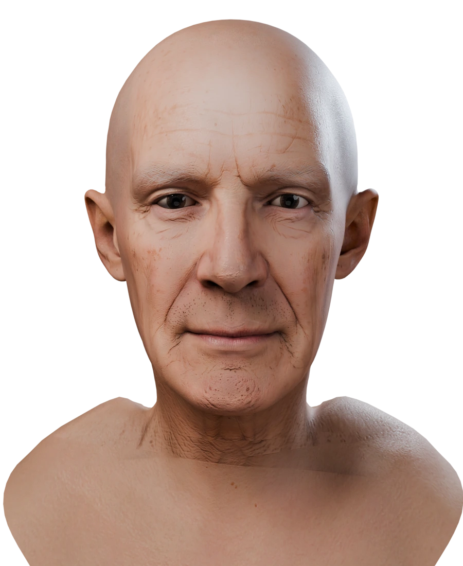 The same head with the neck and shoulders fitted to the person