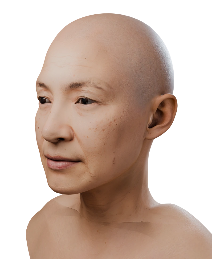 The fitted 3D head with her skin, three-quarter view